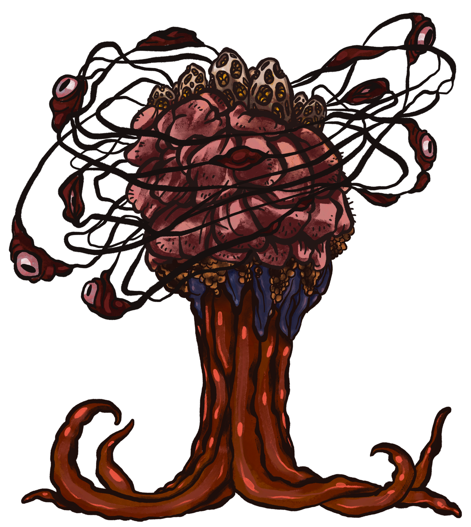 teratoma teratoma